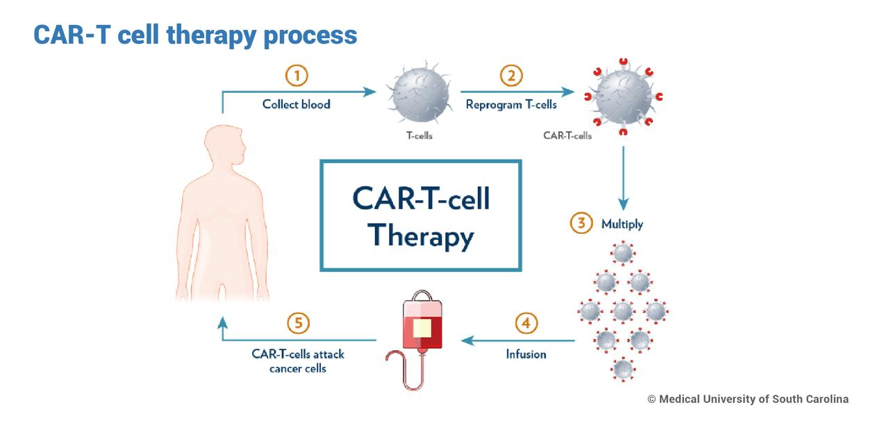 The CAR-T cell therapy process: collect blood, reprogram T-cells, multiply, infusion, attack cancer cells